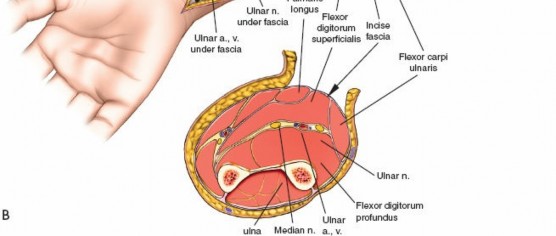 Illustration 95 for Mastering Approaches to the Upper Third of the Radius