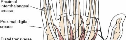 Illustration 140 for Essential Surgical Approaches: Uncover Every Aspect of the Wrist