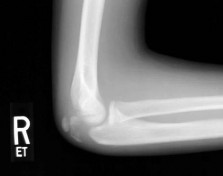 Pediatric Orthopaedic B Review | Dr Hutaif Pediatric Or -...