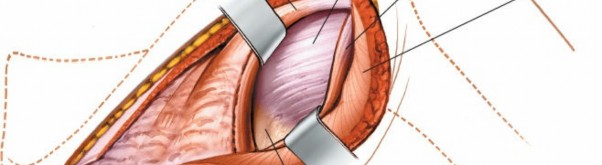 Illustration 174 for Essential Guide: Mastering Every Approach to the Shoulder
