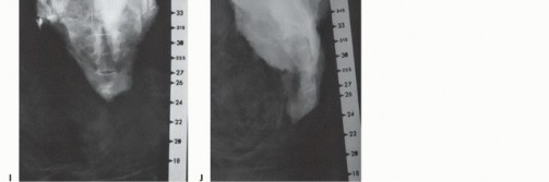 صورة طبية: جراحة أورام العجز: الحفاظ على وظائف الأمعاء والمثانة مع الأستاذ الدكتور محمد هطيف في صنعاء