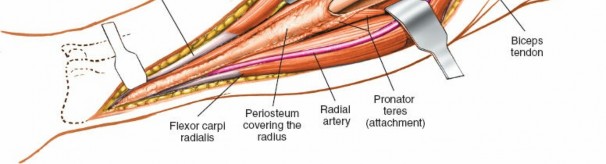 Illustration 18 for Mastering Approaches to the Upper Third of the Radius