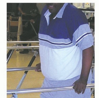 صورة طبية: استئصال مفصل الورك: دليل شامل للمرضى مع الأستاذ الدكتور محمد هطيف