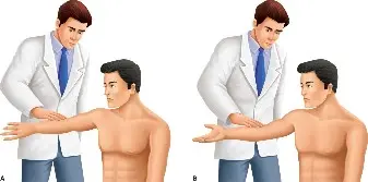 صورة توضيحية لـ تمزق الشفا العلوي الأمامي والخلفي (SLAP): دليلك الشامل للتشخيص والعلاج والتعافي في اليمن مع الأستاذ الدكتور محمد هطيف