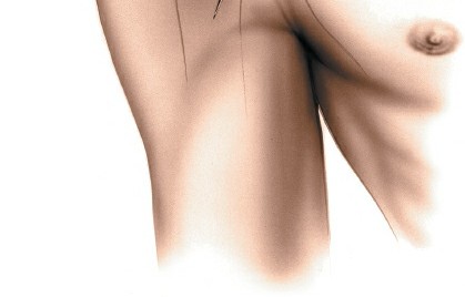 Illustration 9 for Essential Guide: Mastering Every Approach to the Shoulder