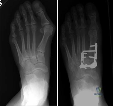 Clinical Image
