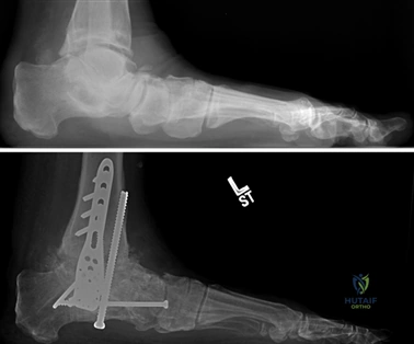 Clinical Image