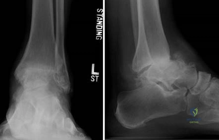 Clinical Image