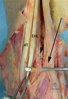 Clinical Image