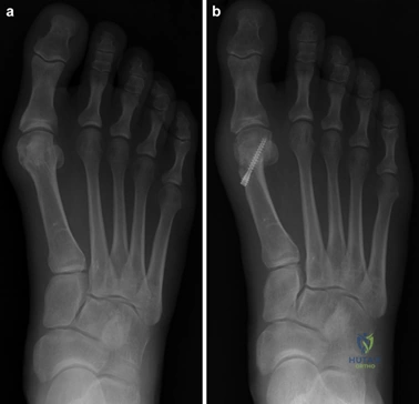 Clinical Image