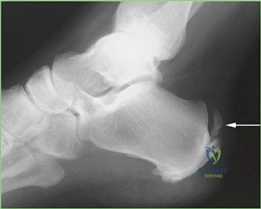 Clinical Image