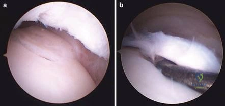 Clinical Image