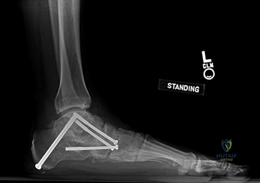 Clinical Image