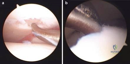 Clinical Image