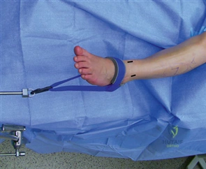 Clinical Image