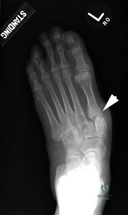 Clinical Image