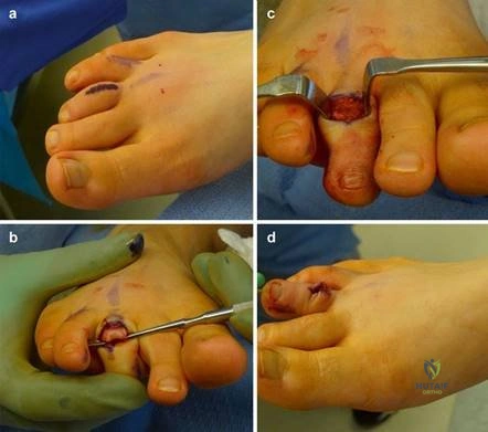 Clinical Image