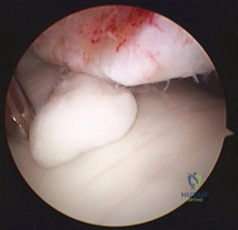 Clinical Image