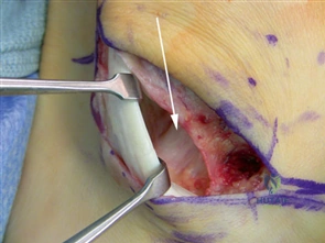 Clinical Image
