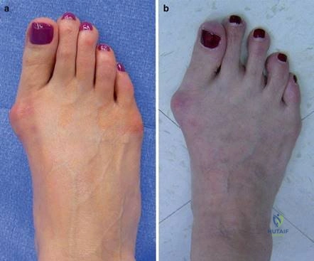 Clinical Image