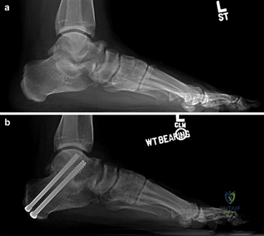Clinical Image