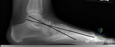 Clinical Image