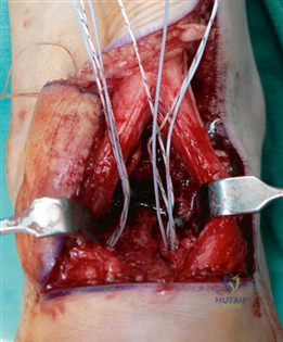 Clinical Image