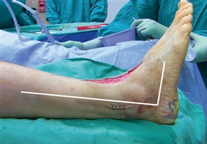 Clinical Image