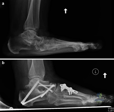 Clinical Image