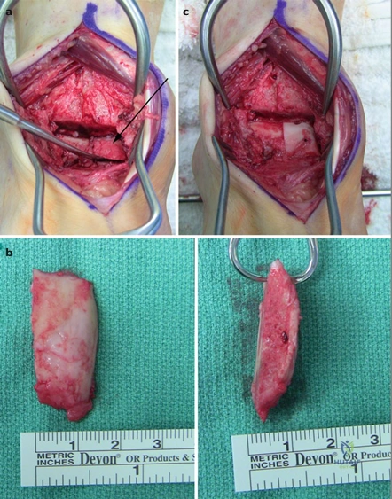 Clinical Image