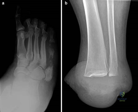 Clinical Image