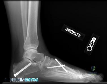 Clinical Image