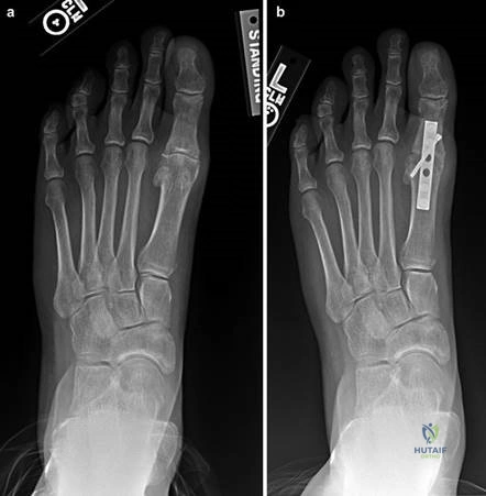 Clinical Image