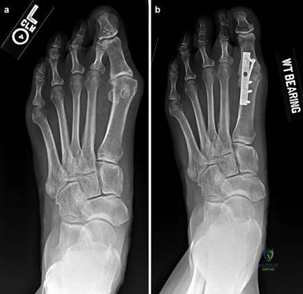 Clinical Image