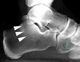 Clinical Image