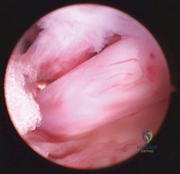 Clinical Image
