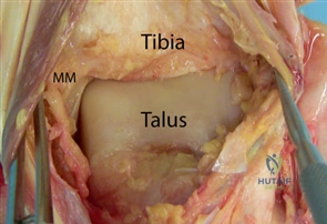 Clinical Image