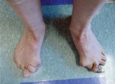 Clinical Image
