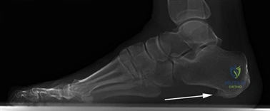 Clinical Image