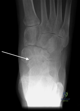 Clinical Image
