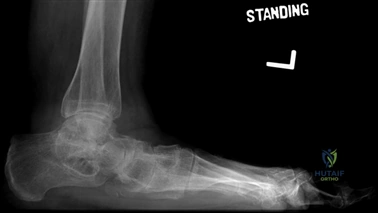 Clinical Image
