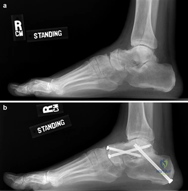 Clinical Image