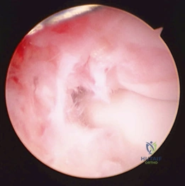 Clinical Image