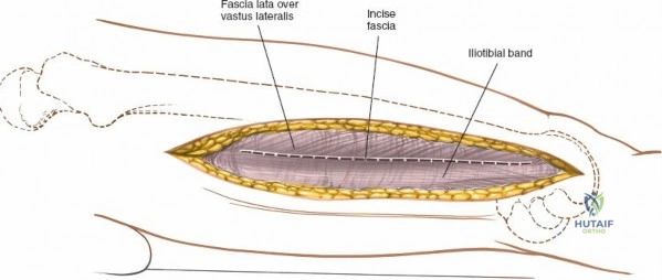 Clinical Image