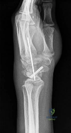 Free Orthopedics Review | Dr Hutaif General Orthopedics -...