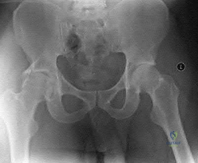 Illustration of mcq and emq - Dr. Mohammed Hutaif