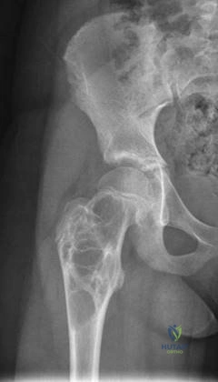 Clinical Image