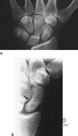 Clinical Image