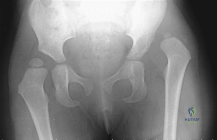 Clinical Image