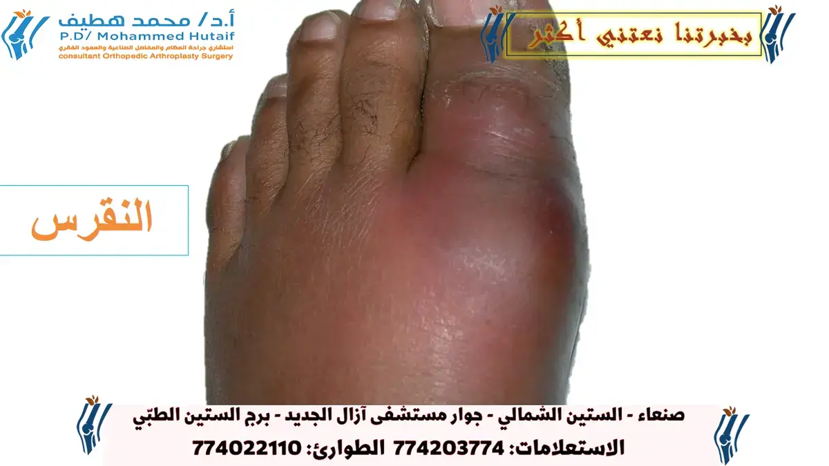 دليلك الشامل: تشريح ووظيفة حزام الكتف 💪